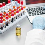 What Are The Key Factors to Consider When Purchasing CLIA Diagnostic Kits