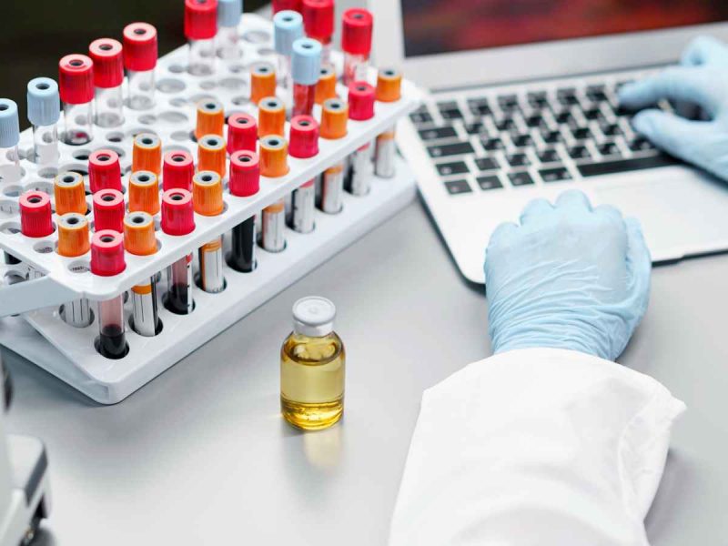 What Are The Key Factors to Consider When Purchasing CLIA Diagnostic Kits